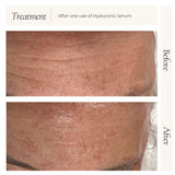 Hyaluronic Serum Mini Size