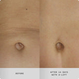A-Lift Overnight Vitamin A Body Treatment PM